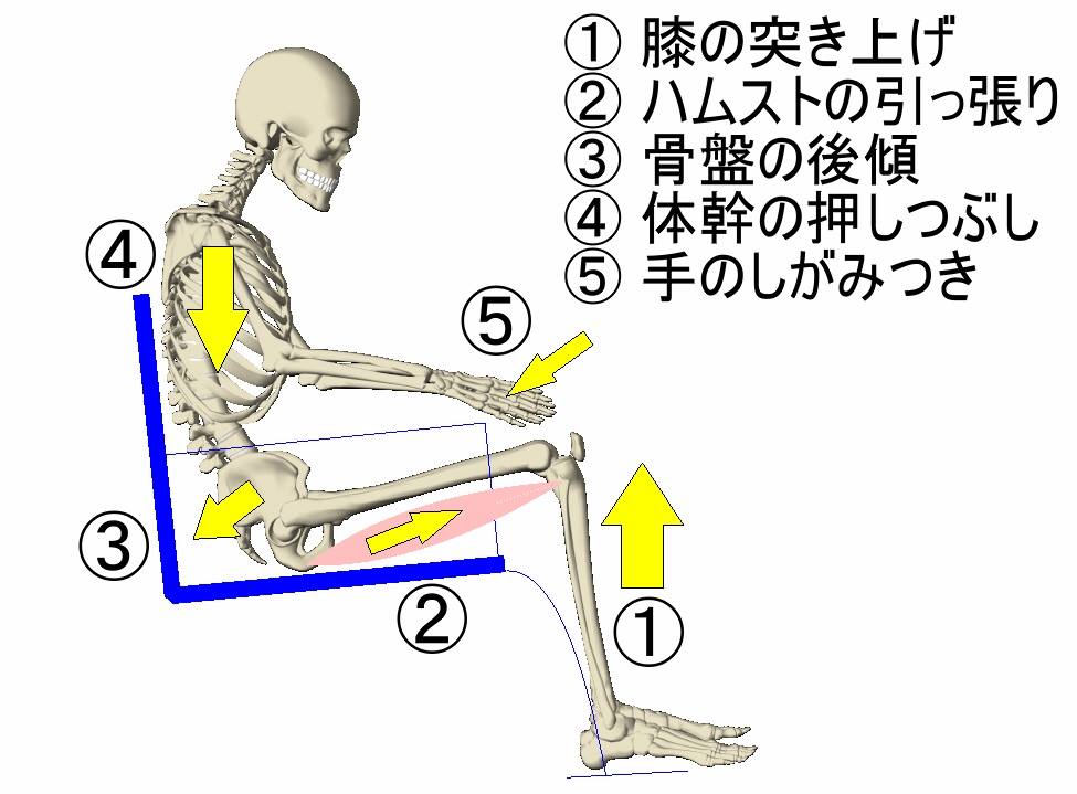 寝たきり老人さんの身体に起きていること ⑫ 関節拘縮の発生３：拘縮の進行